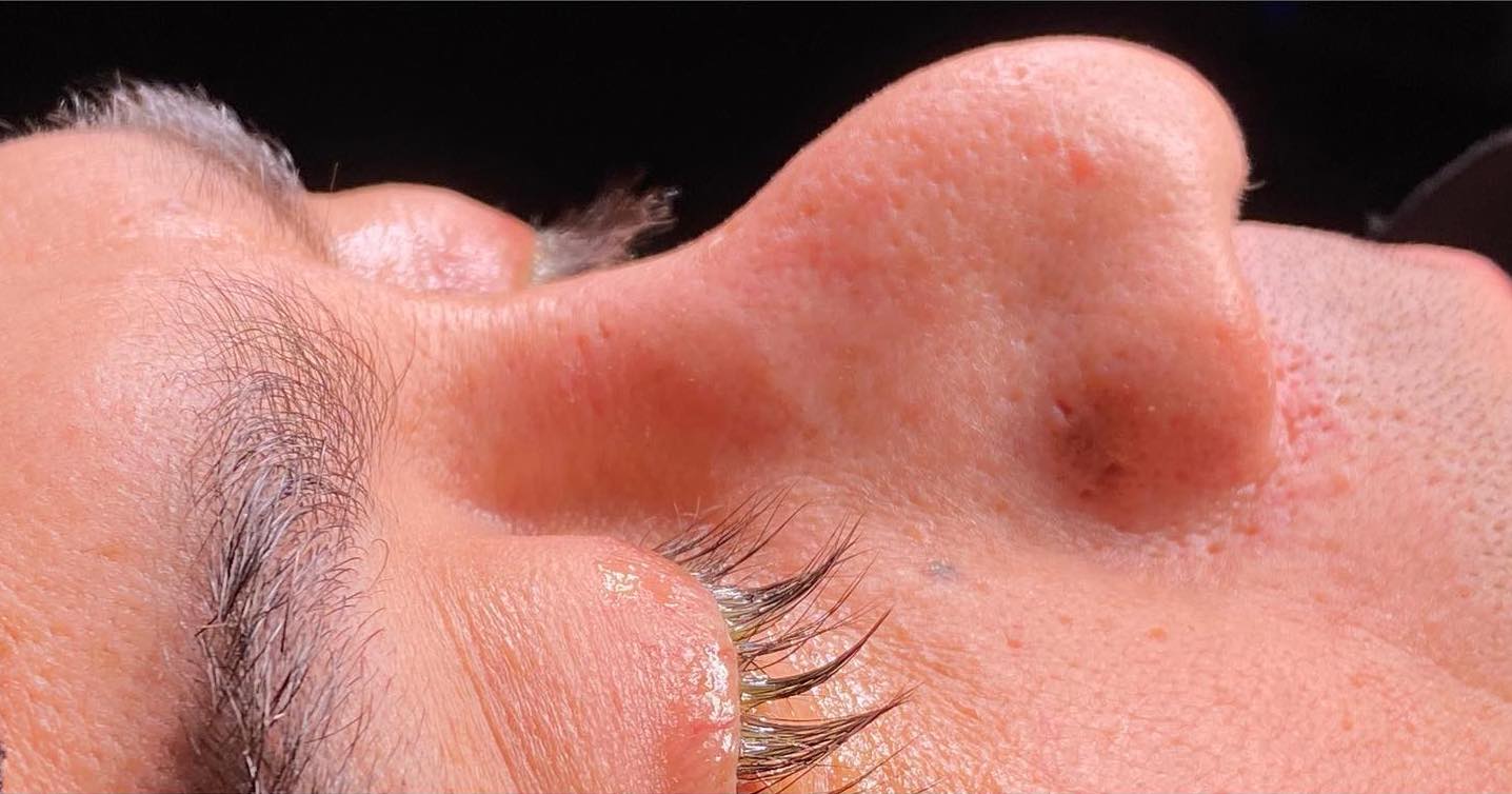Before-facefour